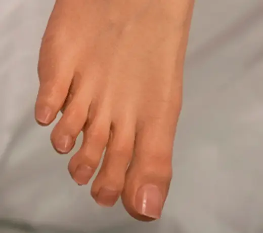 Knees