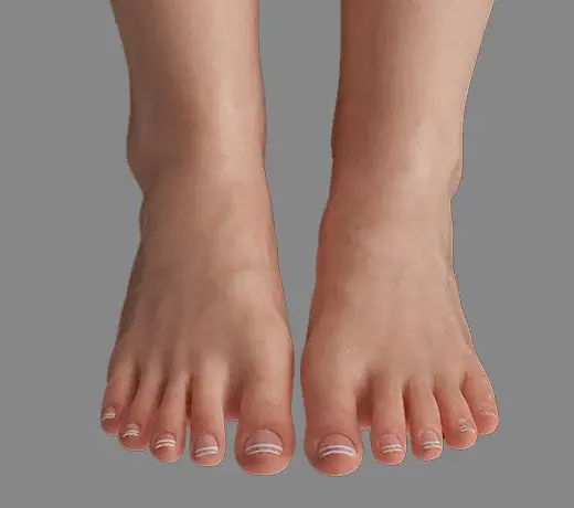 Knees