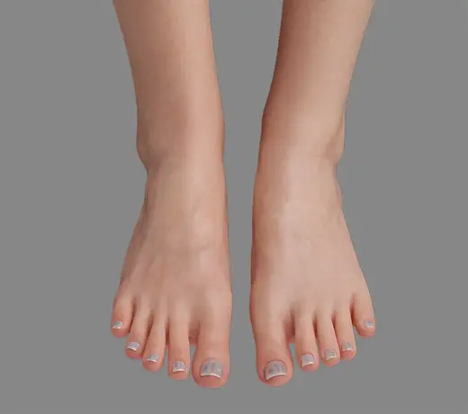 Knees